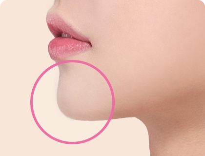 短下巴