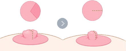 乳头比较宽的情况