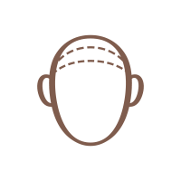 hairline adjusting